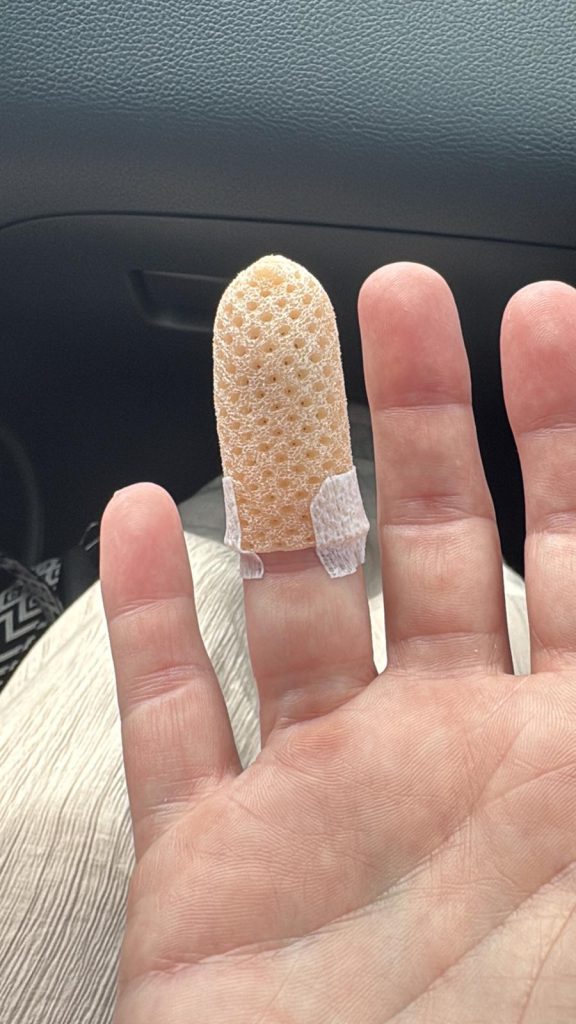 Gebroken vinger - kaatsnieuws.com
